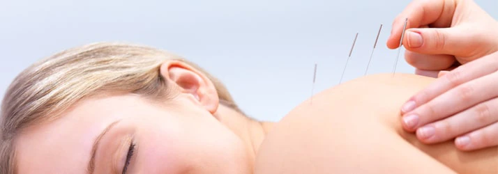 Chiropractic Galesburg IL Acupuncture